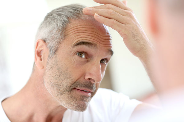 PRP Platelet-Rich Plasma Therapy for Hair Loss